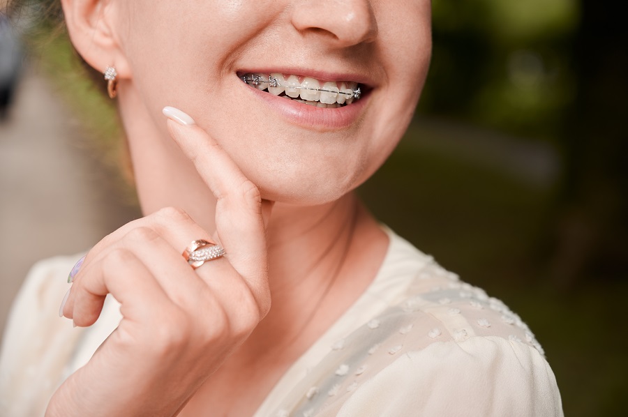 Pros and Cons of Orthodontic Treatments