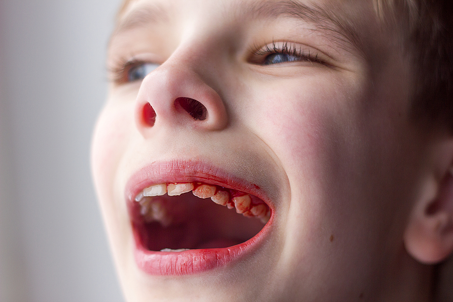 Bad Habits That Can Damage Oral Health
